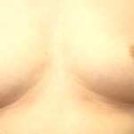 Thumbnail of related posts 196